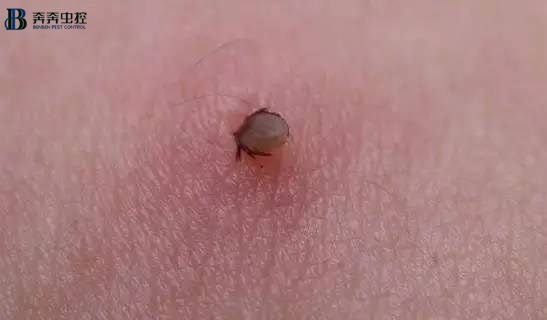解讀蜱蟲預防與處理，值得收藏！