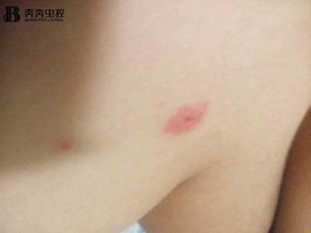 對抗蚊子塊的“終極武器”究竟是什么？